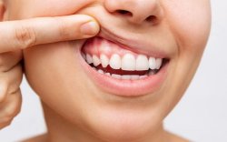 Umuganga w'amenyo avuga ko iyi ngeso yangiza amenyo yawe