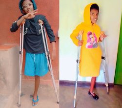 Izabayo Solange akeneye ubufasha bwawe akabona insimburangingo y'ukuguru 