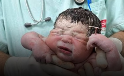 Umwana yavutse apfumbatije agapira ko kuboneza urubyaro kashyizwe muri nyina ngo adasama!