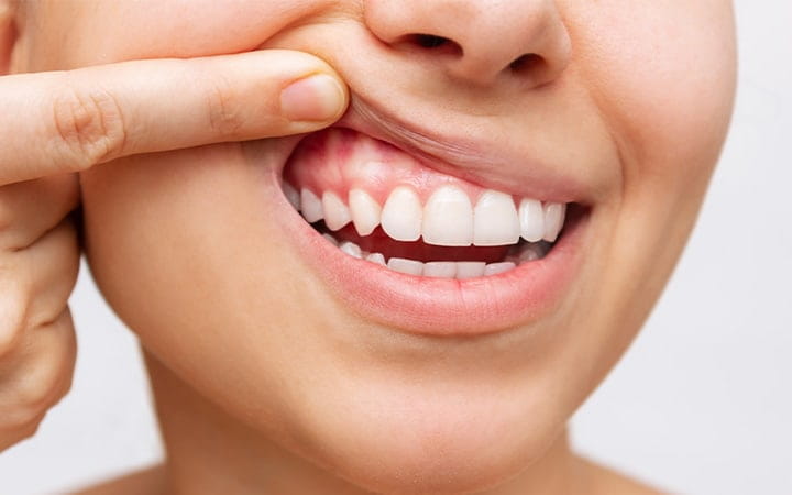 Umuganga w'amenyo avuga ko iyi ngeso yangiza amenyo yawe